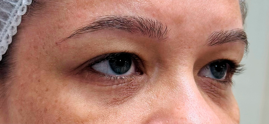 Antes do procedimento